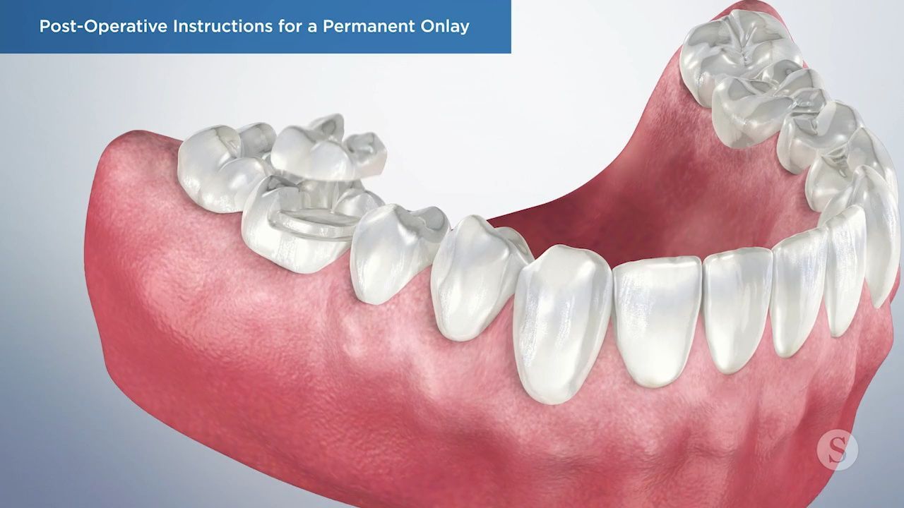 Brushing technique for hybrid denture care