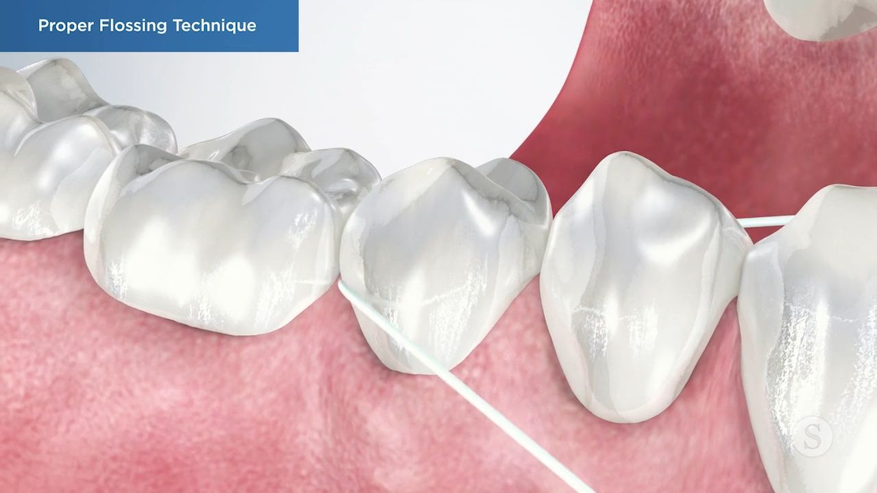 Illustration of proper flossing technique.