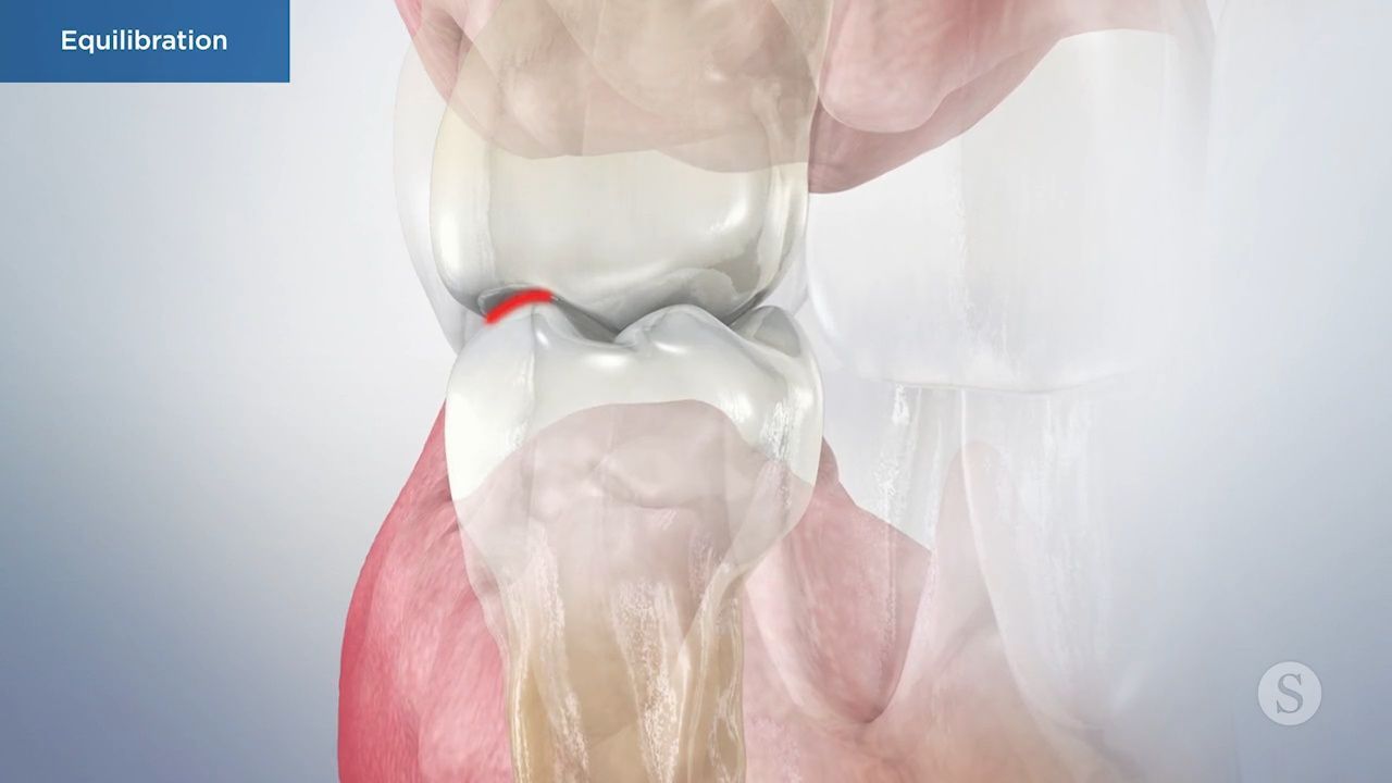 Illustration of knee joint anatomy and equilibrium.