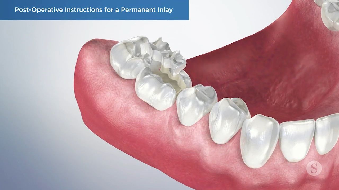 Illustration of proper flossing technique.