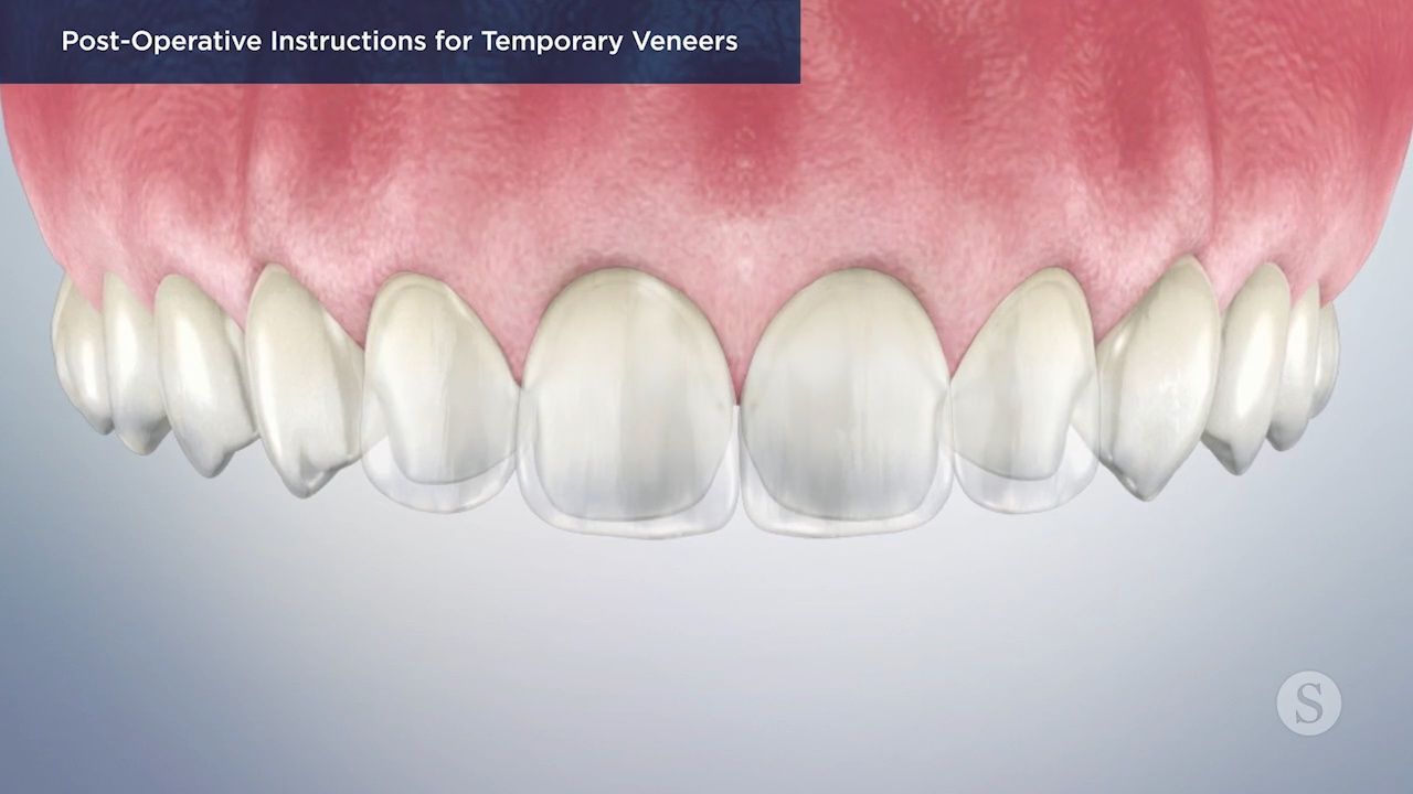 Diagram of healthy dental occlusion.