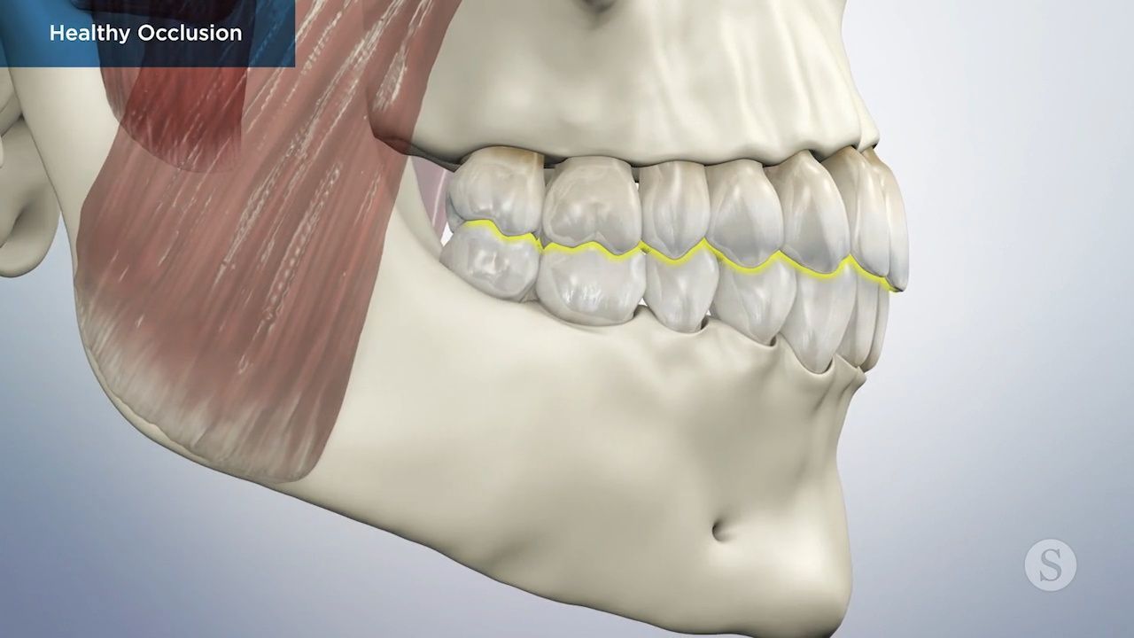 Diagram of healthy dental occlusion.