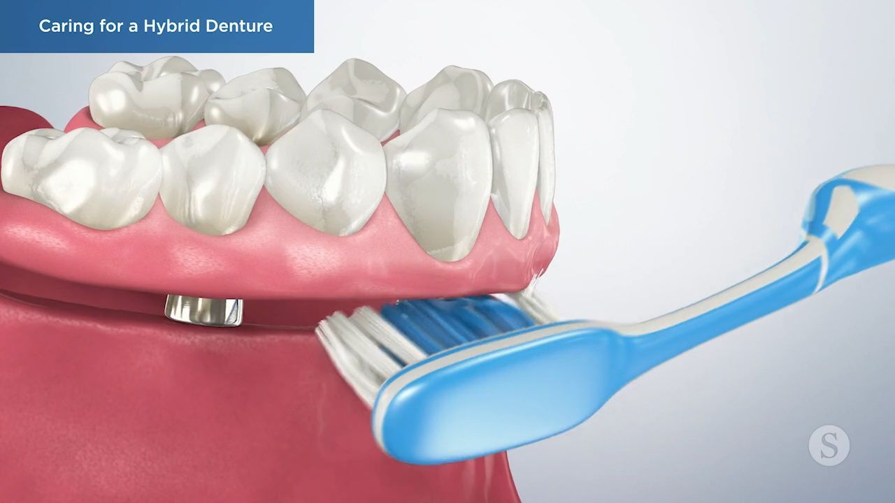 Brushing technique for hybrid denture care